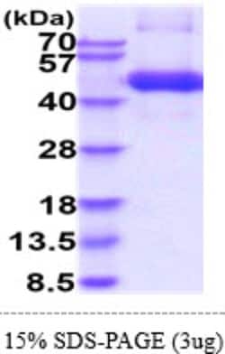 Novus Biologicals Recombinant Human TGF-beta RI/ALK-5 Isoform 1 Protein 250 &mu;g | Buy Online | Novus Biologicals&trade; | Fisher Scientific